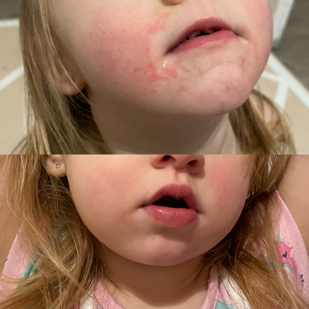 Bioskin Junior Daily Face Moisturiser