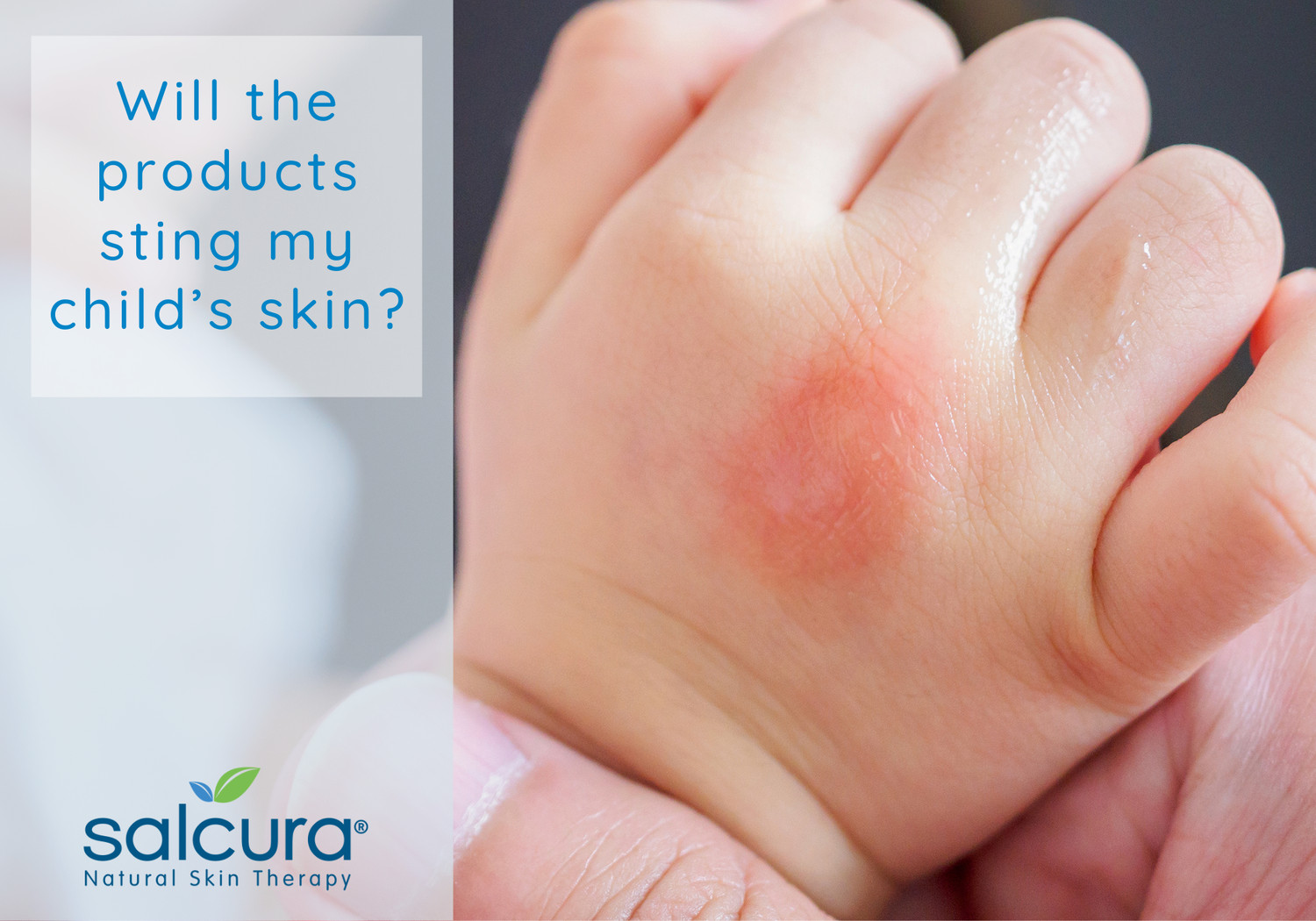 Will the products sting my child's skin?