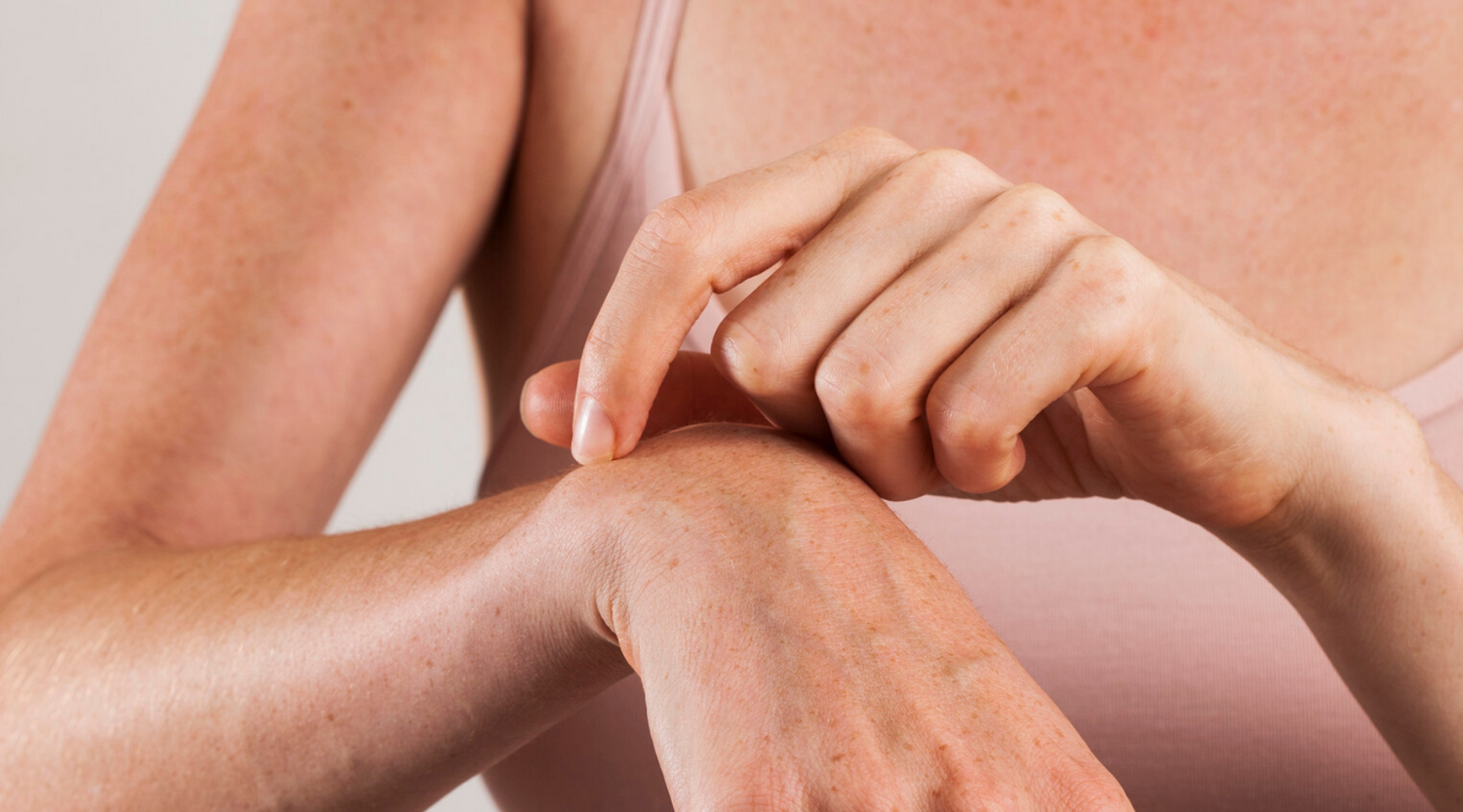 Dry & Dehydrated Skin