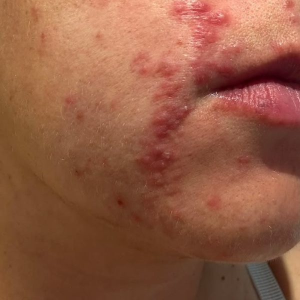 Before - Dori V.